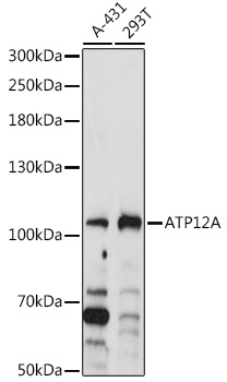 ATP12A Polyclonal Antibody (E-AB-90821)
