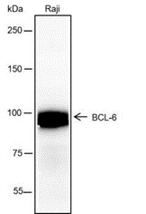 Recombinant BCL6 Monoclonal Antibody (AN301444L)