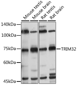 TRIM32 Polyclonal Antibody (E-AB-92755)