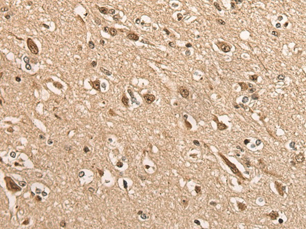 BATF Polyclonal Antibody (E-AB-18532)
