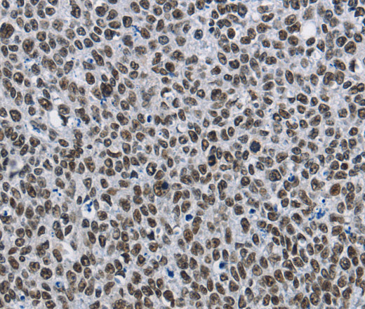 CMTM2 Polyclonal Antibody (E-AB-14002)