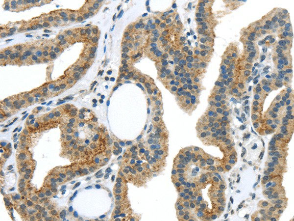 VAMP2 Polyclonal Antibody (E-AB-17544)