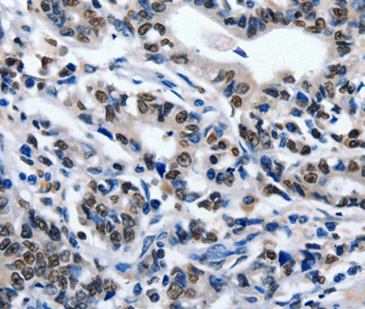 CD203c Polyclonal Antibody (E-AB-12389)