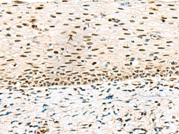 ABI2 Polyclonal Antibody (E-AB-18253)