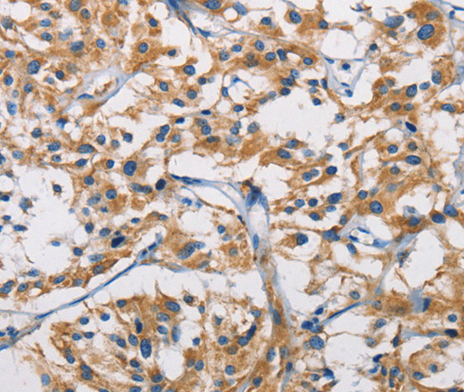 HK1 Polyclonal Antibody (E-AB-14707)