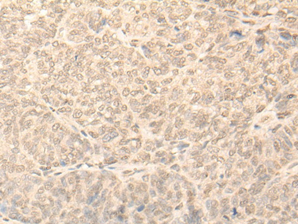 NARF Polyclonal Antibody (E-AB-18713)