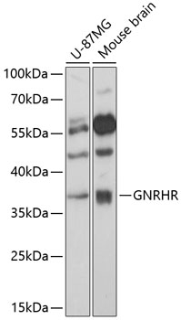 GNRHR Polyclonal Antibody (E-AB-90864)