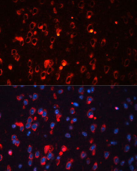 KCNA1 Polyclonal Antibody (E-AB-66980)