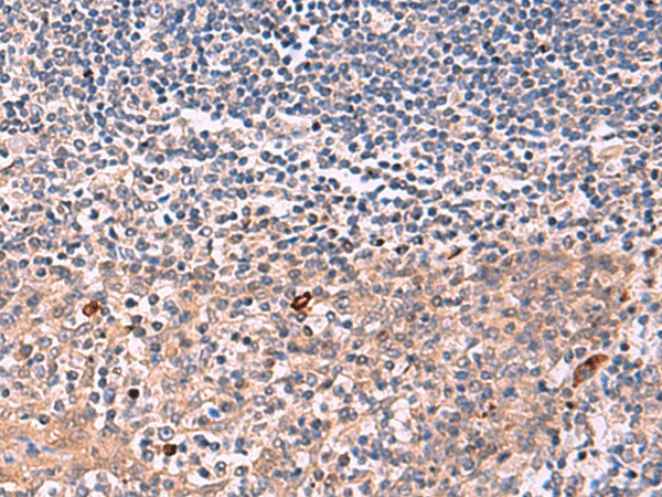 IFNA1/IFNA13 Polyclonal Antibody (E-AB-52067)