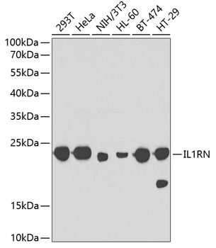 IL1RN Polyclonal Antibody (E-AB-60596)