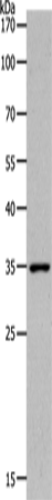 MC2R Polyclonal Antibody (E-AB-12555)