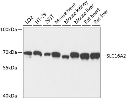 SLC16A2 Polyclonal Antibody (E-AB-65446)