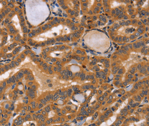 CCL23 Polyclonal Antibody (E-AB-13115)