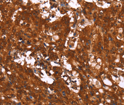 HCAR2 Polyclonal Antibody (E-AB-13276)