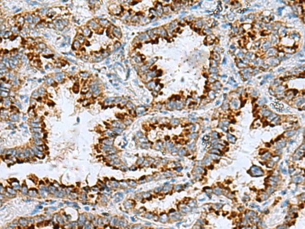 FAAP100 Polyclonal Antibody (E-AB-19184)