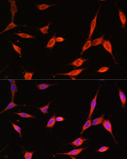 PIK3R3 Polyclonal Antibody (E-AB-67104)