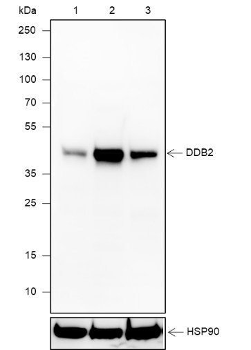 Recombinant DDB2 Monoclonal Antibody (AN301920L)
