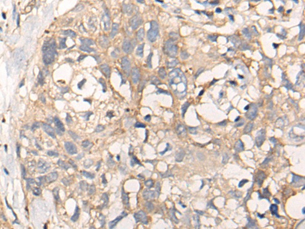 NREP Polyclonal Antibody (E-AB-19428)