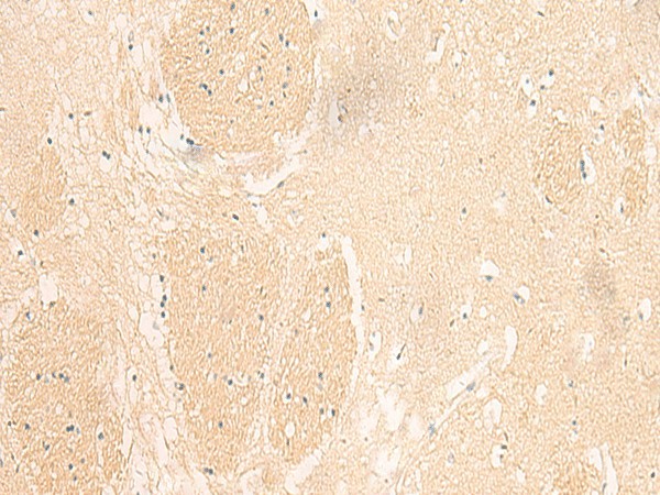 IL37 Polyclonal Antibody (E-AB-52019)