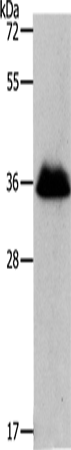 RNF126 Polyclonal Antibody (E-AB-12633)