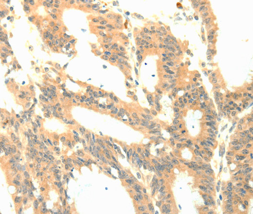 P23 Polyclonal Antibody (E-AB-14420)