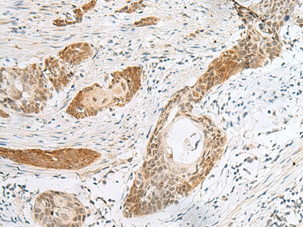 HIST1H2BK Polyclonal Antibody (E-AB-18892)