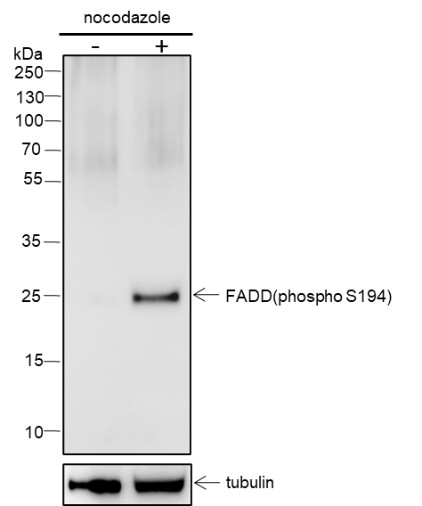 Recombinant Phospho-FADD (S194) Monoclonal Antibody (AN302084L)