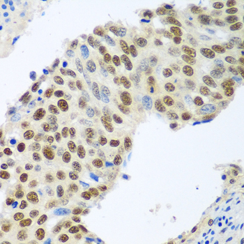 MDC1 Polyclonal Antibody (E-AB-63008)