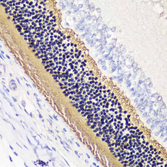 PDC Polyclonal Antibody (E-AB-65063)