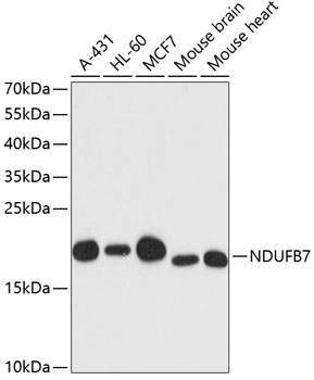 NDUFB7 Polyclonal Antibody (E-AB-64793)