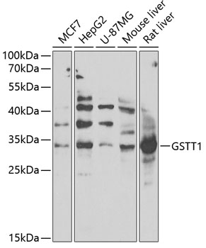 GSTT1 Polyclonal Antibody (E-AB-93108)