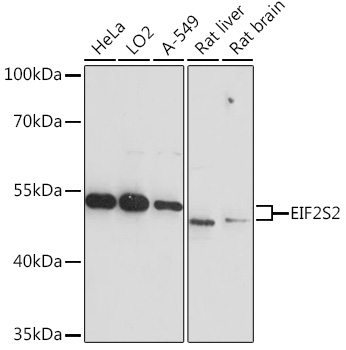 EIF2S2 Polyclonal Antibody (E-AB-91685)