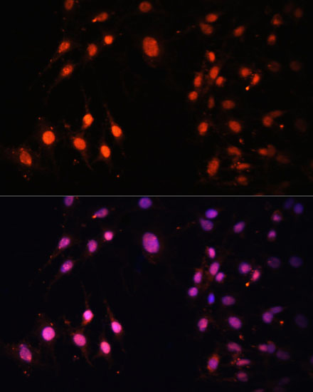 SETD2 Polyclonal Antibody (E-AB-60870)