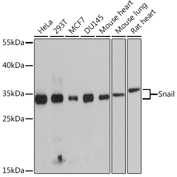 Snail Polyclonal Antibody (E-AB-63597)