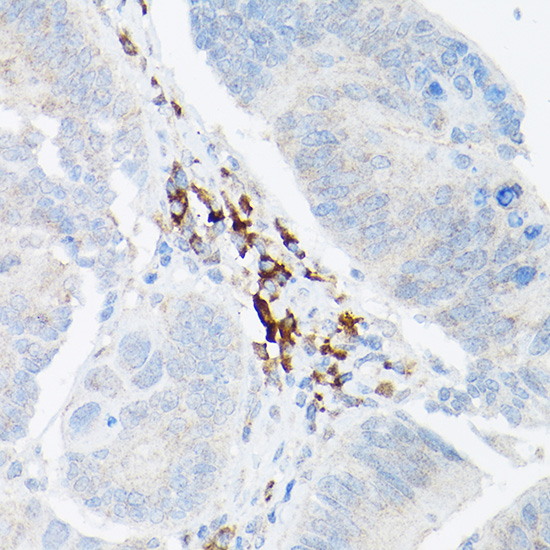 TNF-α Polyclonal Antibody (E-AB-68252)