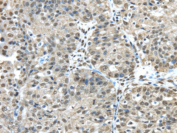 FUS Polyclonal Antibody (E-AB-17100)