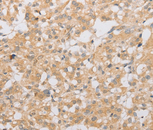 ATG9A Polyclonal Antibody (E-AB-10943)