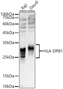 HLA-DPB1 Polyclonal Antibody (E-AB-93211)