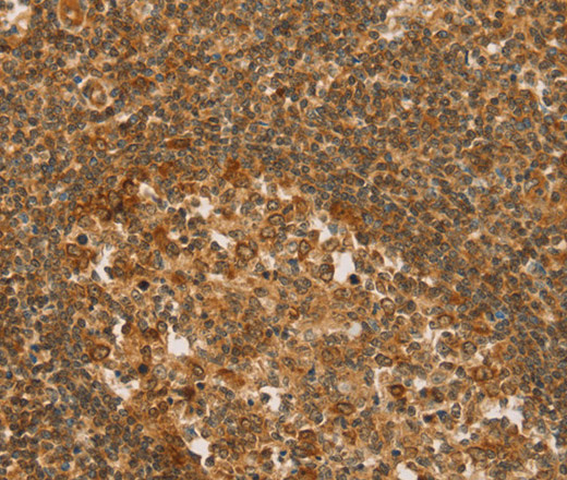SLC6A3 Polyclonal Antibody (E-AB-12361)
