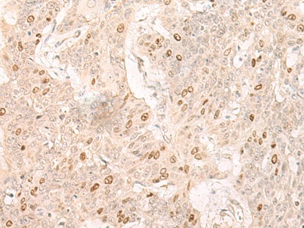 IL7 Polyclonal Antibody (E-AB-19812)