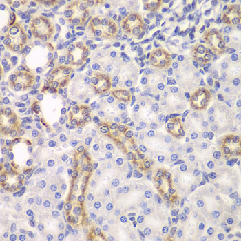 KEAP1 Polyclonal Antibody (E-AB-60460)