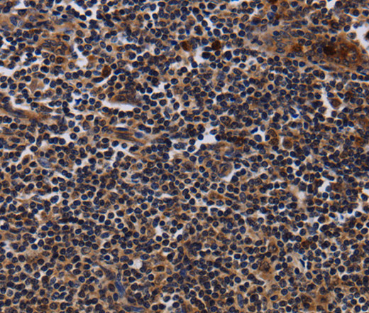 NTMT1 Polyclonal Antibody (E-AB-15200)