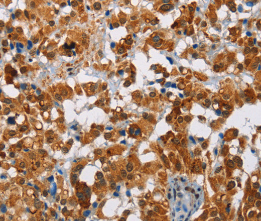 ATXN1 Polyclonal Antibody (E-AB-10990)