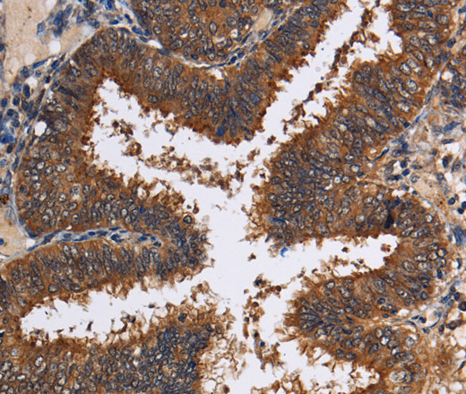 LRRC57 Polyclonal Antibody (E-AB-11371)