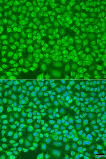 PNKD Polyclonal Antibody (E-AB-65574)