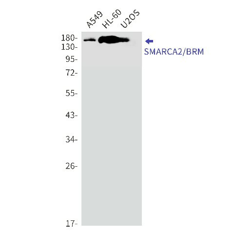 Recombinant SMARCA2 Monoclonal Antibody (E-AB-81511)