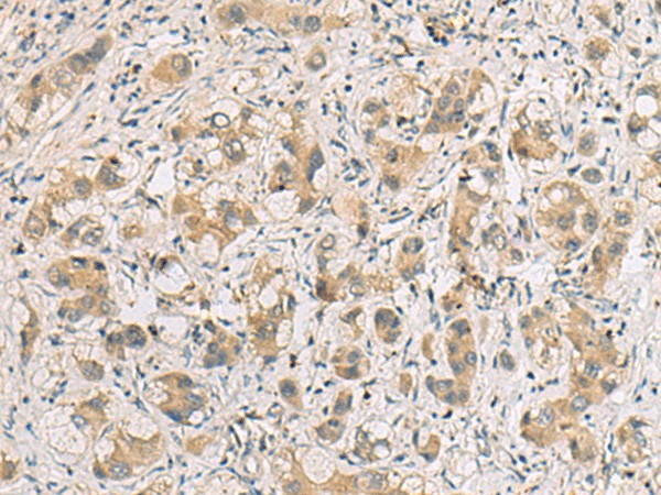RTP4 Polyclonal Antibody (E-AB-19188)