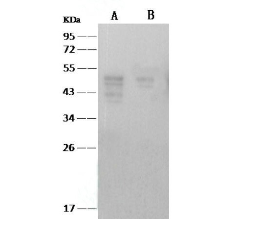Anti-SARS-CoV Nucleoprotein / NP Monoclonal Antibody (E-AB-V1342)