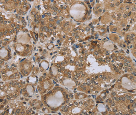 STMN2/3/4 Polyclonal Antibody (E-AB-12534)