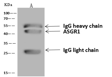 Recombinant ASGPR1 Monoclonal Antibody (AN300206P)